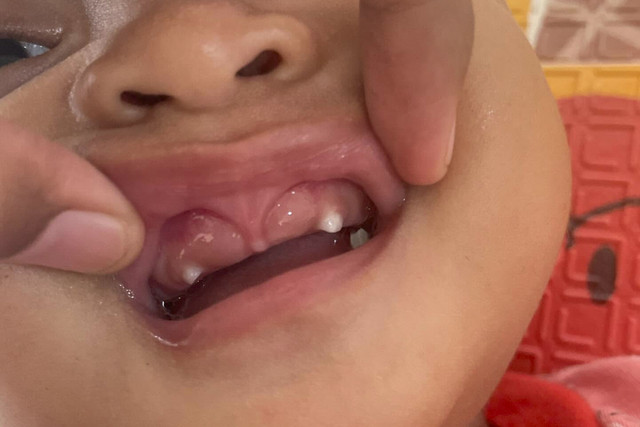 Bayi tumbuh gigi taring terlebih dahulu. Foto: Threads/ @yulivdewi