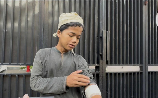 Repan, pemuda Baduy Dalam yang menjadi korban pembacokan orang tidak dikenal saat ditemui di kawasan Jakarta Barat pada Selasa (4/11/2025). Foto: Luthfi Humam/kumparan