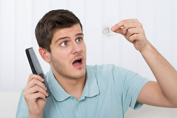 Ilustrasi rambut rontok. Foto: iStock