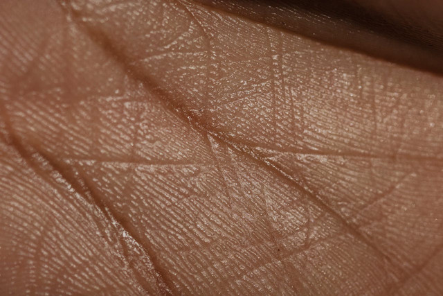 Ilustrasi kulit manusia. Foto: Pexels