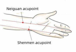 Ilustrasi Titik Akupunktur Untuk Insomnia (Sumber Gambar: https://www.shanghaimedicalclinic.com/)