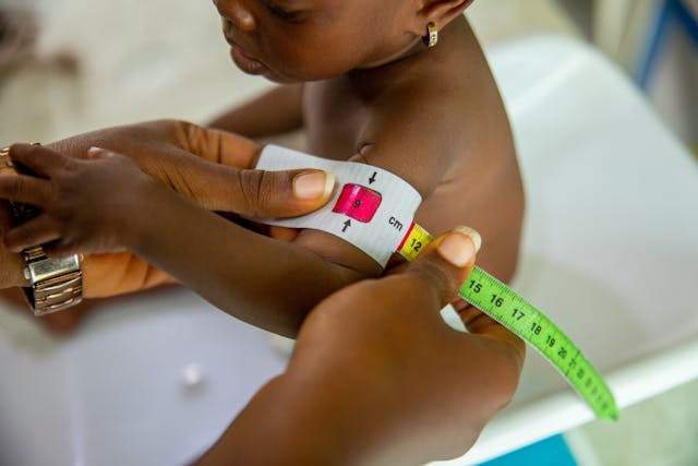 Ilustrasi Anak dengan Stunting. Foto: Pexels.
