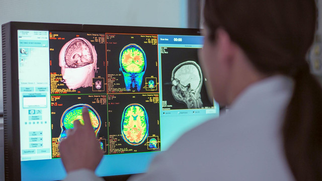 Penelitian Mengungkap 5 Tahap Perkembangan Otak–Masa Remaja Berakhir di Usia 32