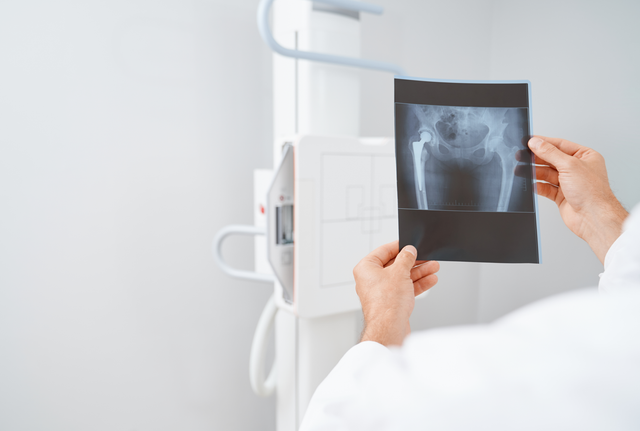 Hasil citra radiologi (Sumber : idn.freepik.com)