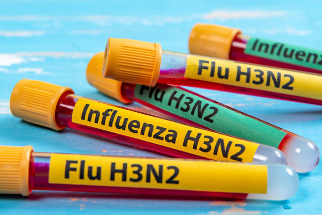 Ilustrasi foto dari virus H3N2. Foto: Celso Pupo/Shutterstock