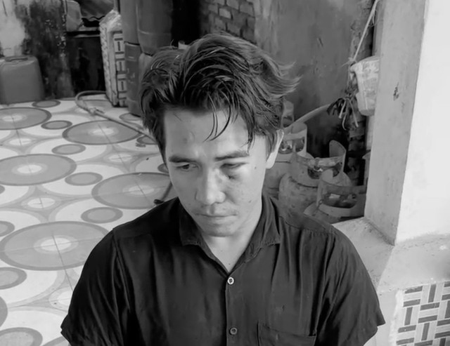 Wajah babak belur Akbar karena dikeroyok polisi di Maros, Sulsel. Dok: Istimewa