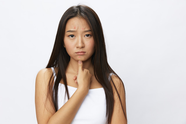 Ilustrasi kulit mengalami penuaan. Foto: ShotPrime Studio/Shutterstock