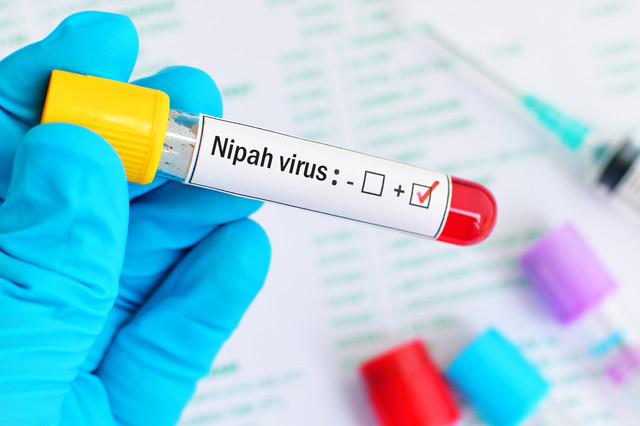 Ilustrasi Virus Nipah Foto: Jarun Ontakrai/Shutterstock