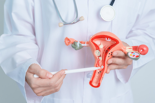  Ilustrasi Kanker Serviks. Foto: Jo Panuwat D/Shutterstock