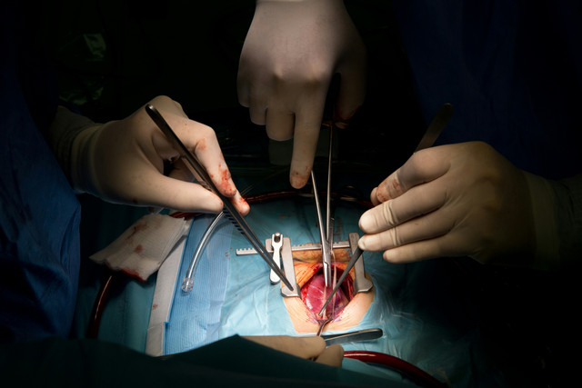 Ilustrasi transplantasi organ. Foto: Adrian Sulyok/Unsplash