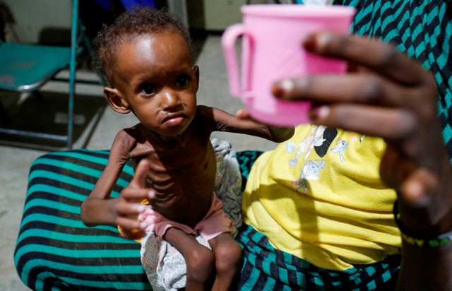 Saddam Najwa, seorang anak pengungsi berusia 17 bulan yang kekurangan gizi, mengulurkan tangan untuk mengambil secangkir air di bangsal anak Rumah Sakit Ibu Pengasih di Gidel, wilayah Pegunungan Nuba, Sudan, pada 25 Juni 2024. Foto: Thomas Mukoya/REUTERS