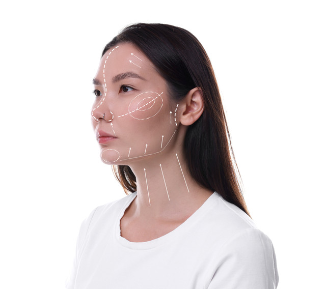 Ilustrasi operasi plastik facelift. Foto: New Africa/Shutterstock