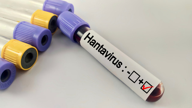 Ilustrasi Hantavirus. Foto: faniadiana24/Shutterstock