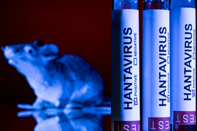 Ilustrasi Tes Hantavirus. Foto: Joel Saget/AFP