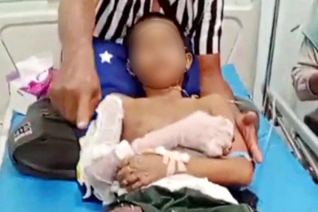 Kondisi santri yang terluka diduga akibat luka bakar. Foto: Dok. Istimewa