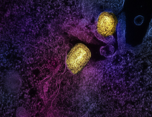 Ilustrasi Virus. Foto: commons.wikimedia.org