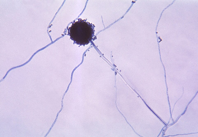 Aspergillus. Foto: Wikimedia Commons