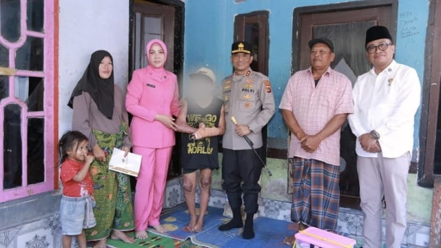 Kapolda NTB Irjen Pol Kalingga Rendra Raharja menjenguk santri yang dibakar kakak kelasnya di Lombok Tengah, Selasa (7/7). Foto: Dok. Humas Polda NTB