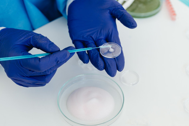https://www.pexels.com/id-id/foto/tangan-penelitian-menempatkan-bioteknologi-8540136/. Egg Freezing menjadi trend yang sedang dilakukan wanita muda masa kini.