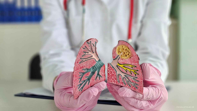 Ilustrasi. Foto Istimewa