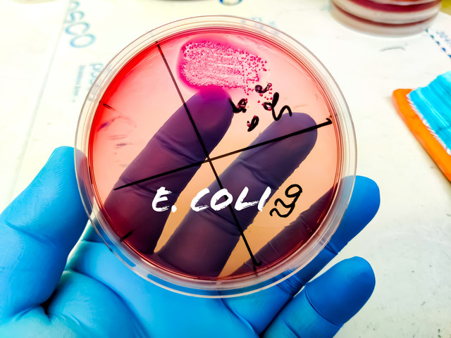 Ilustrasi Escherichia coli atau E. Coli. Foto: Arif biswas/Shutterstock