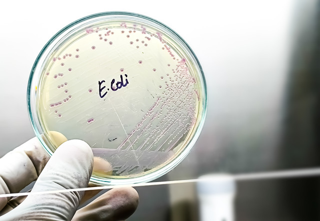 Ilustrasi Escherichia coli atau E. Coli. Foto: Saiful52/Shutterstock