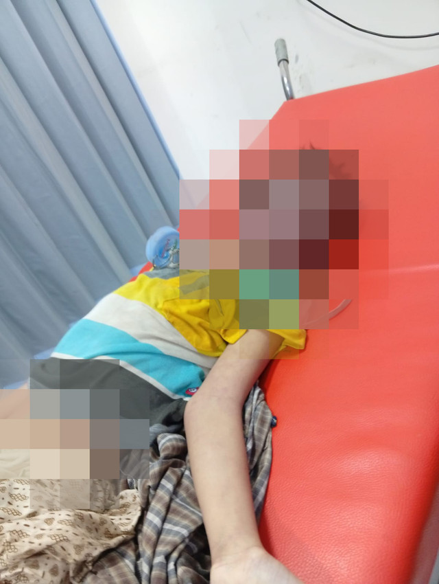 Bocah penderita down syndrome asal Kecamatan Rungkut, Surabaya, berinisial Z (10) meninggal dunia diduga dibully oleh 2 anak tetangganya. Foto: Dok. Istimewa