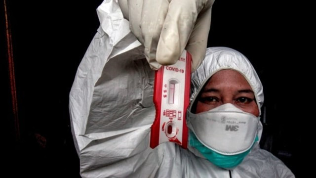 Ilustrasi hasil tes COVID-19. Foto: istimewa