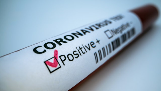 Ilustasi - Positif COVID-19 - IST