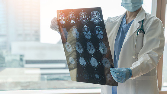 Ilustrasi Penyakit Tidak Menular. Foto: Unsplash.com