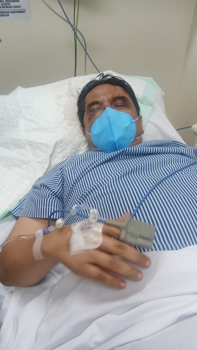 Kondisi Terkini Ade Armando Usai dikeroyok saat demo. Foto: Dok. Istimewa