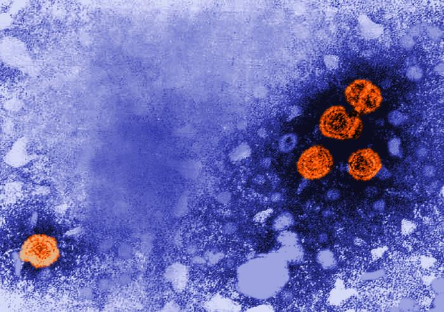 Gambar mikroskopis elektron transmisi (TEM) ini mengungkapkan adanya partikel virus hepatitis B (HBV) (oranye). Virion bulat, yang berukuran diameter 42nm, dikenal sebagai partikel Dane. Foto: CDC/Dr. Erskine Palme