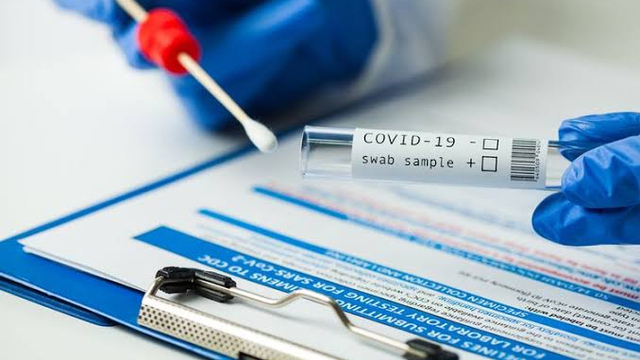 Ilustrasi syarat PCR COVID-19. Foto: Istimewa.