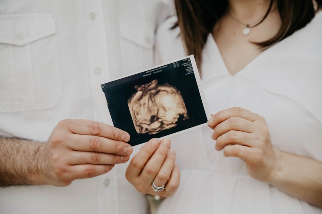 Ilustrasi janin. Foto: Pexels/Melike Benli