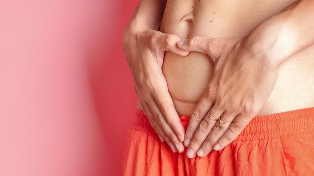 Kenapa Vagina Terasa Nyeri Setelah Operasi Caesar? Foto: Shutterstock