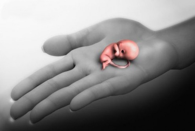 Ilustrasi : gambar bayi aborsi, Foto : Pixabay.com
