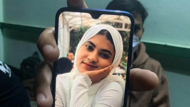 Foto istri korban penyiraman air keras oleh WNA Arab Saudi di Cianjur. Foto: Dok. Istimewa