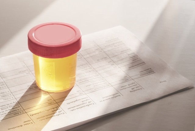 Kondisi urine dapat dikatakan sehat apabila tidak terdapat zat-zat yang seharusnya terbuang. Foto: Pixabay