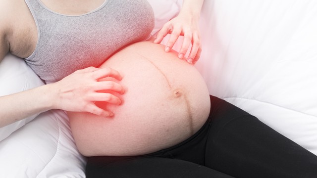 Kulit ibu hamil gatal kemerahan. Foto: Shutterstock