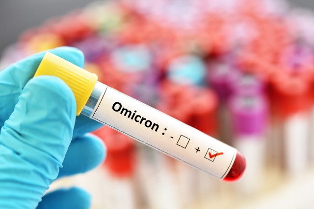 Ilustrasi virus corona Omicron.
 Foto: Shutterstock