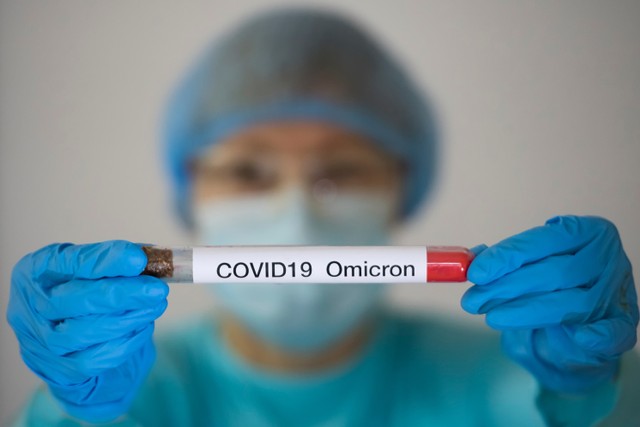 Ilustrasi virus corona Omicron.
Foto: Shutterstock