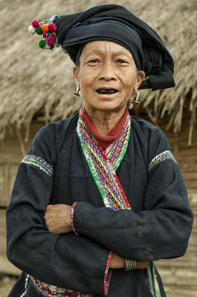 Tradisi menghitamkan gigi Suku Lu. Foto: Shutter Stock