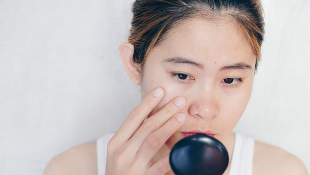 Ilustrasi ingin menghilangkan komedo di wajah. Foto: Pixabay