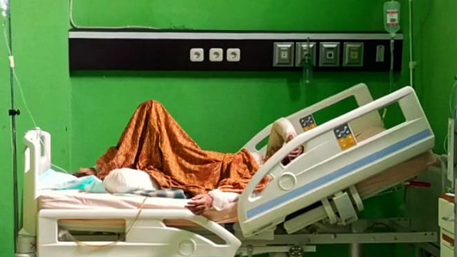 Fatimah saat masih menjalani perawatan di rumah sakit usai dibakar suaminya. (ist)