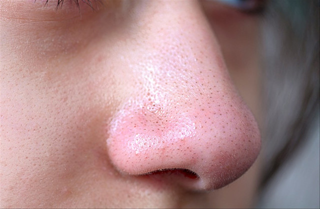 Ilustrasi menghilangkan komedo hitam di hidung dengan baby oil. Foto: Unsplash.com