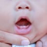Gigi Bayi