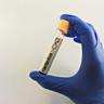 Wabah Hantavirus di Kapal Pesiar