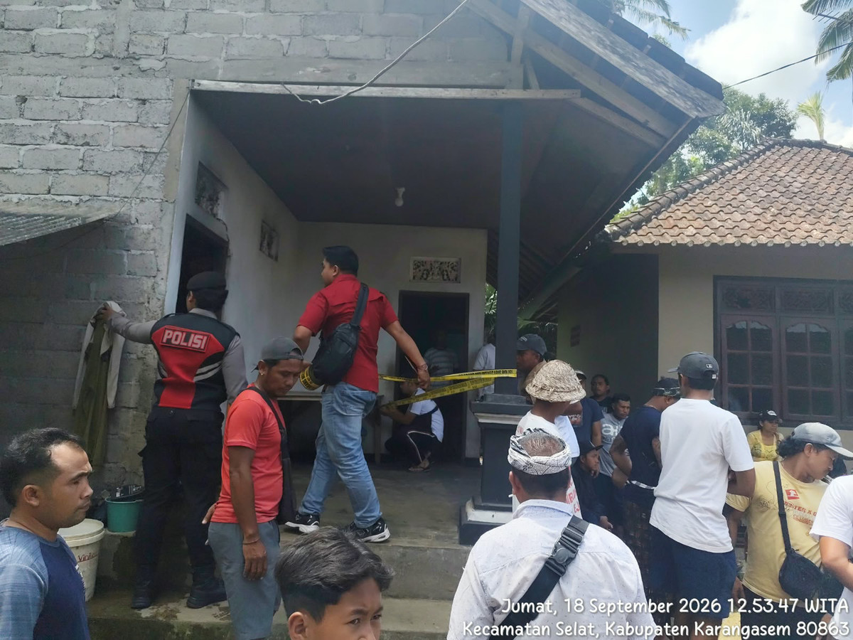 Nahas, Sopir di Bali Dibakar Hidup-hidup Gara-gara Setoran Kurang