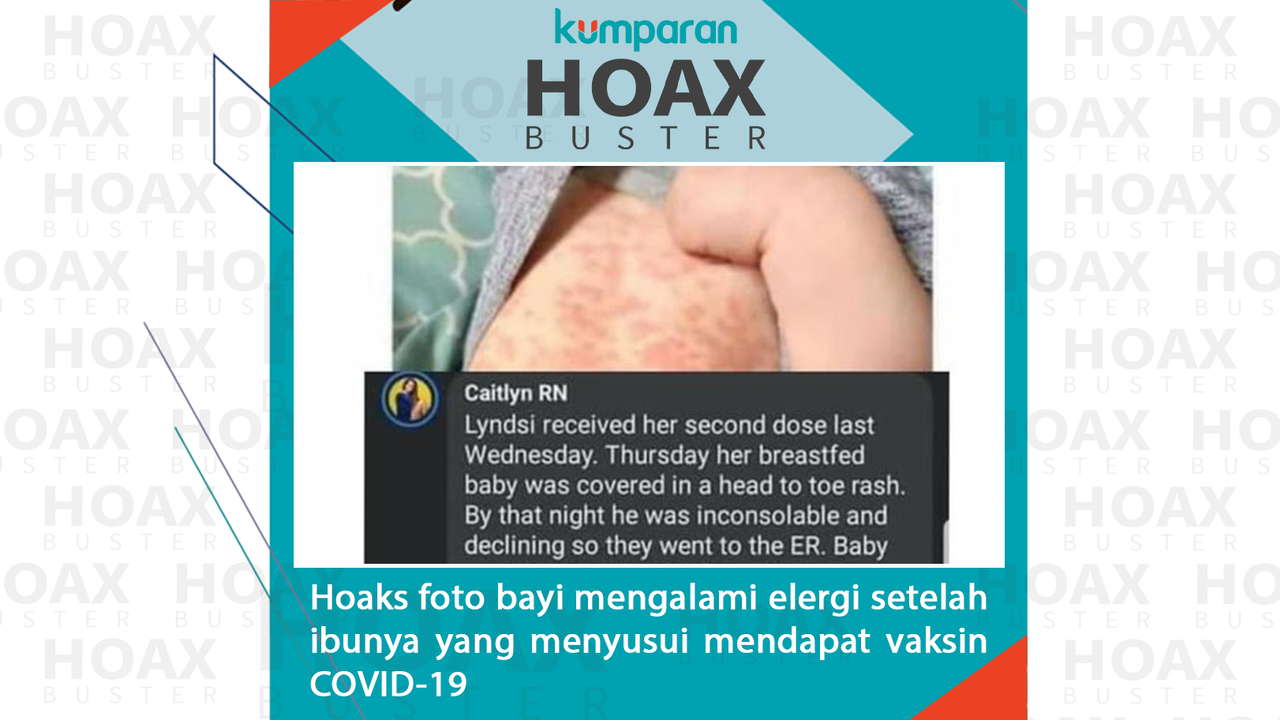 Hoax bayi alergi setelah ibunya mendapat vaksin COVID-19