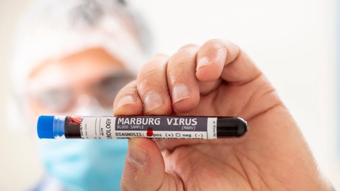 Ilustrasi virus Marburg. Foto: Mauro Rodrigues/Shutterstock
